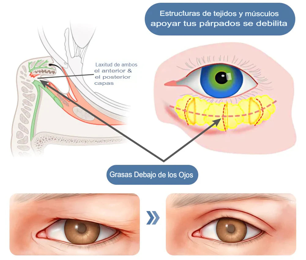 AGE REVERSE CONTORNO DE OJOS